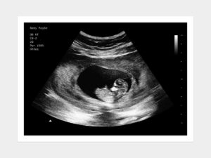 8 Weeks Fake Ultrasound Image